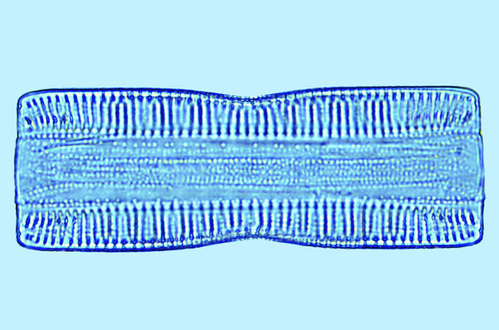 Divers Navicula sp.